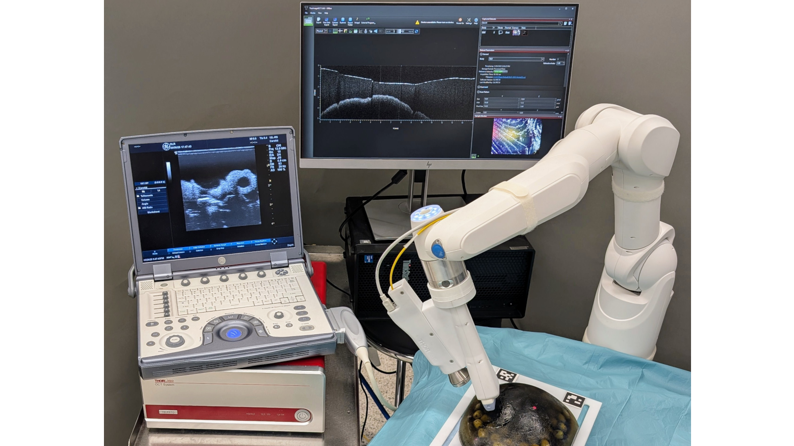 Man sieht den weißen Roboterarm MIRO, während er direkt am OP-Tisch assistiert und automatisch und präzise Gewebe untersucht.