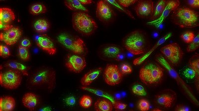 „Live-Cell Imaging“ im Weltraum