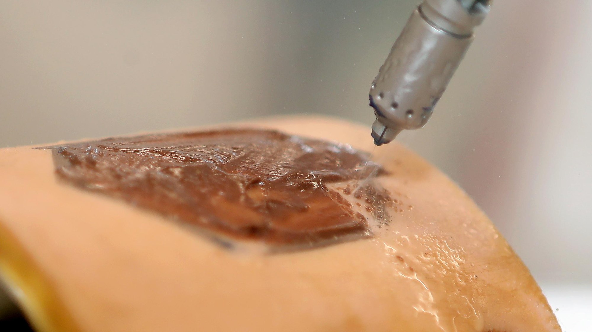 DLR MIRO Wundreinigung mit Wasserstrahl