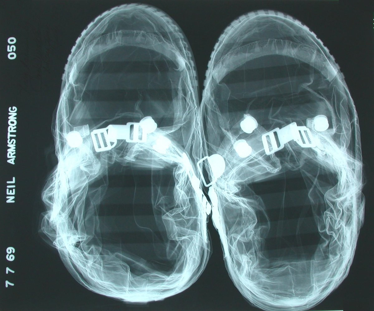 Neil Armstrongs „Mond-Schuhe“ im Röntgenbild.