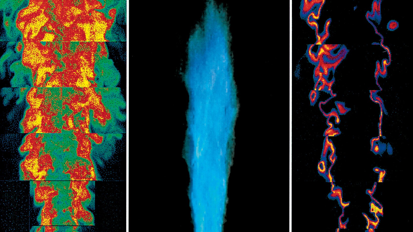 Collage Laserdiagnostik