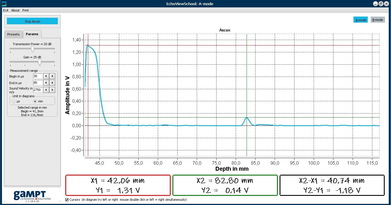 Messchart (A-Mode) einer Ultraschalluntersuchung