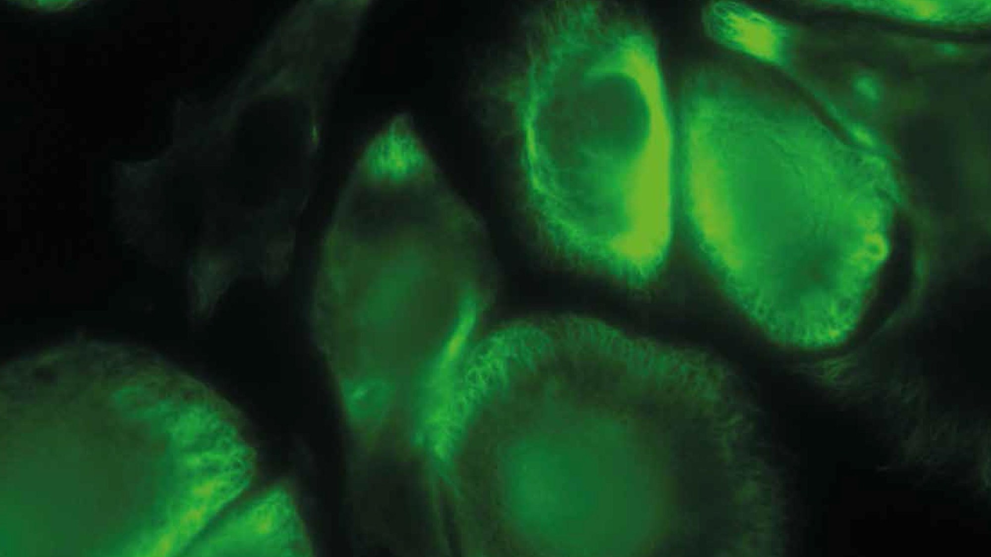 FLUMIAS is a high-resolution fluorescence microscope for use on the ISS