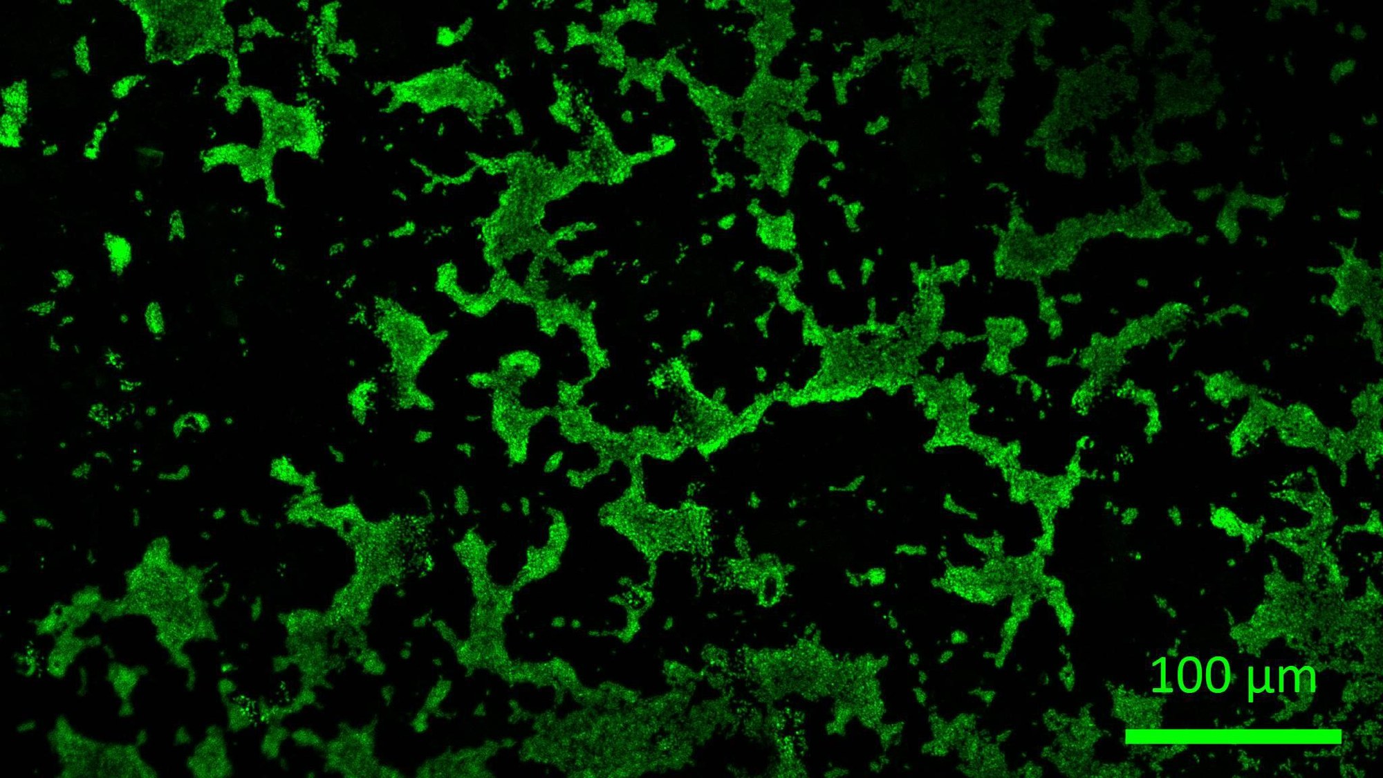 Bacillus subtilis Biofilm