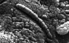 Der Mars-Meteorit unter dem Mikroskop: Diese Formation halten manche Wissenschaftler für versteinerte Bakterien. Bild: NASA 