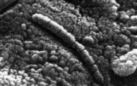 Ein Stück Mars-Gestein unter dem Mikroskop. Handelt es sich bei der seltsamen Form um versteinerte Bakterien? Bild: NASA